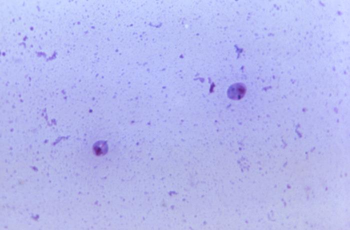 Amastigotes de Leishmania brasiliensis. CDC Public Health Image Library (PHIL).           