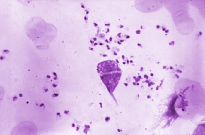 Amastigotes de Leishmania donovani. CDC Public Health Image Library (PHIL).              