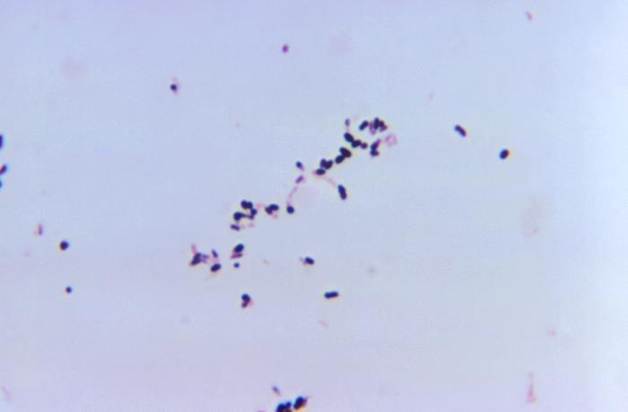 Corynebacterium pseudotuberculosis