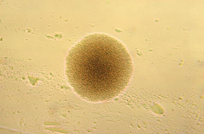 Colonia de Corynebacterium pseudotuberculosis