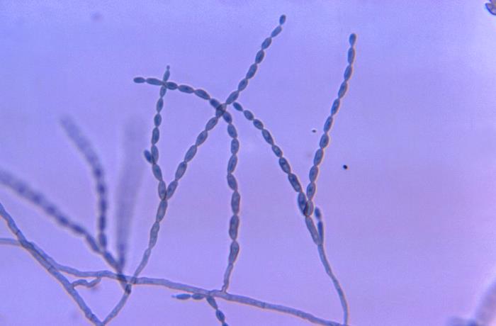 Conidióforos de Cladophialophora bantiana. CDC Public Health Image Library (PHIL).