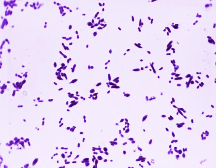 Streptococcus pneumoniae. CDC Public Health Image Library (PHIL).