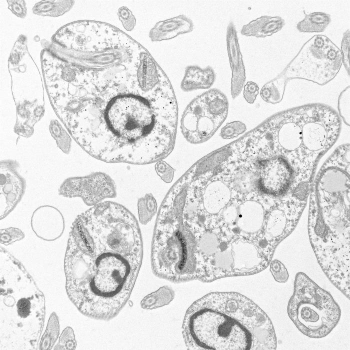 Amastigotes de Leishmania major. CDC Public Health Image Library (PHIL).                          