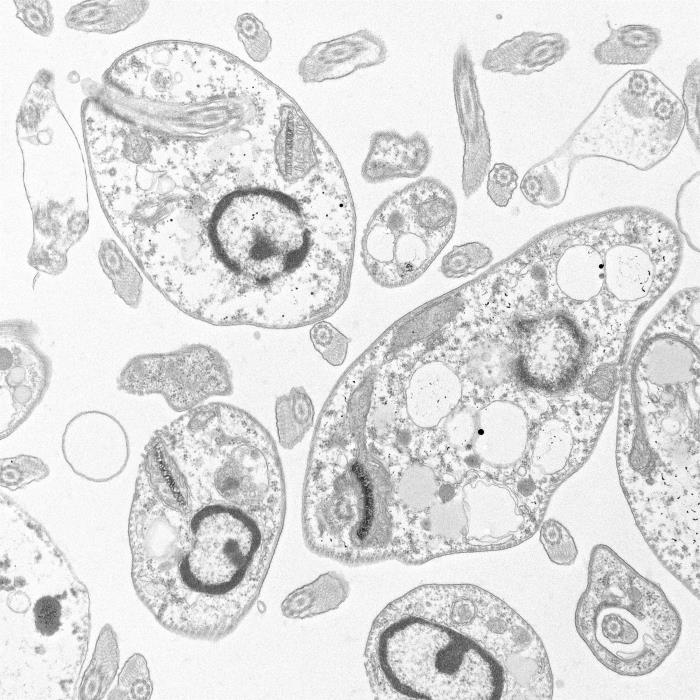 Amastigotes de Leishmania major. CDC Public Health Image Library (PHIL). 