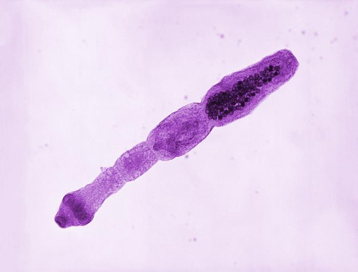 Adulto de Echinococcus multilocularis. CDC Public Health Image Library (PHIL).