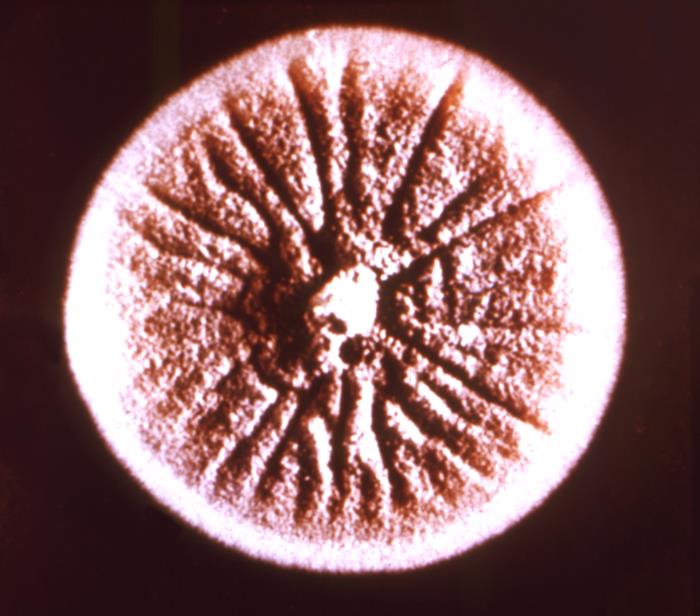 Colonia S. schenckii. CDC Public Health Image Library (PHIL).