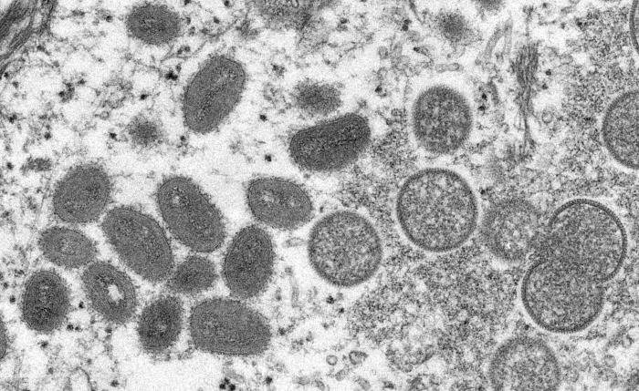 Virus de la viruela de los simios. CDC Public Health Image Library (PHIL).
