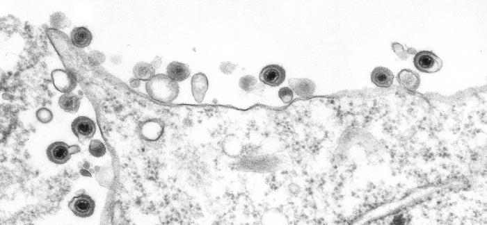 Virus de HVH-8. CDC Public Health Image Library (PHIL).