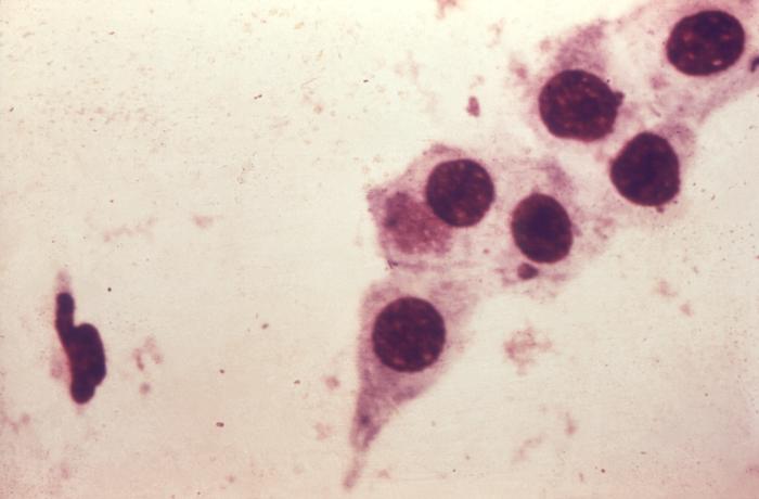 Chlamydia trachomatis. CDC Public Health Image Library (PHIL).