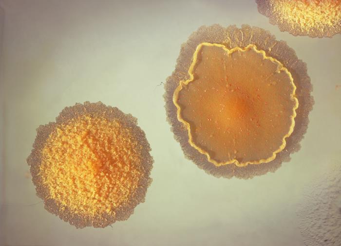 Colonia de Mycobacterium. CDC Public Health Image Library (PHIL). 