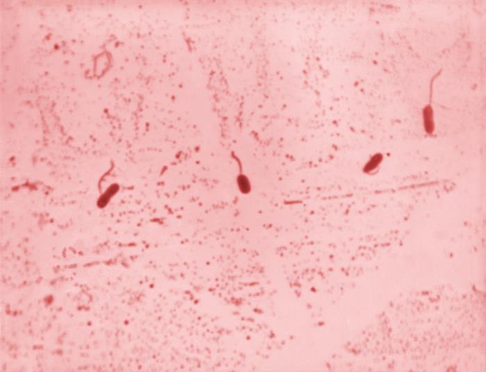 Vibrio cholerae. CDC Public Health Image Library (PHIL).