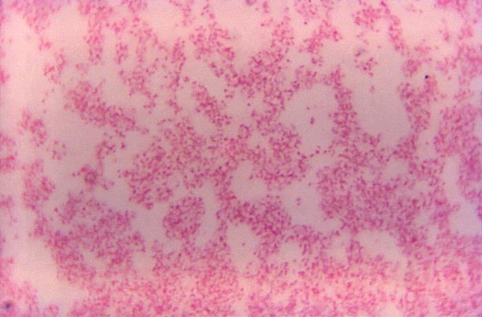 Cocobacilos de Francisella tularensis. CDC Public Health Image Library (PHIL).