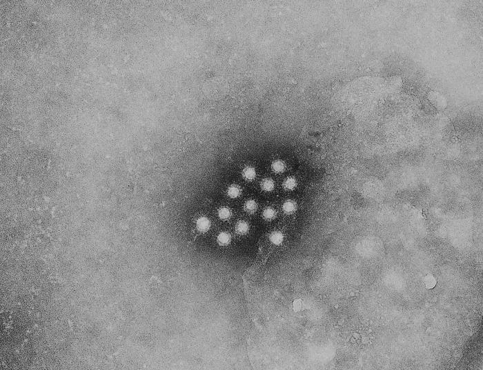 Virus de la hepatitis A. CDC Public Health Image Library (PHIL).