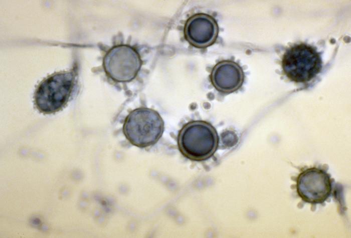 Conidios de Histoplasma capsulatum. CDC Public Health Image Library (PHIL).