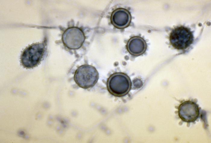 Conidios de Histoplasma capsulatum