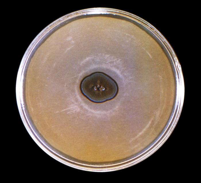 Cladosporium carrionii.  CDC Public Health Image Library (PHIL).