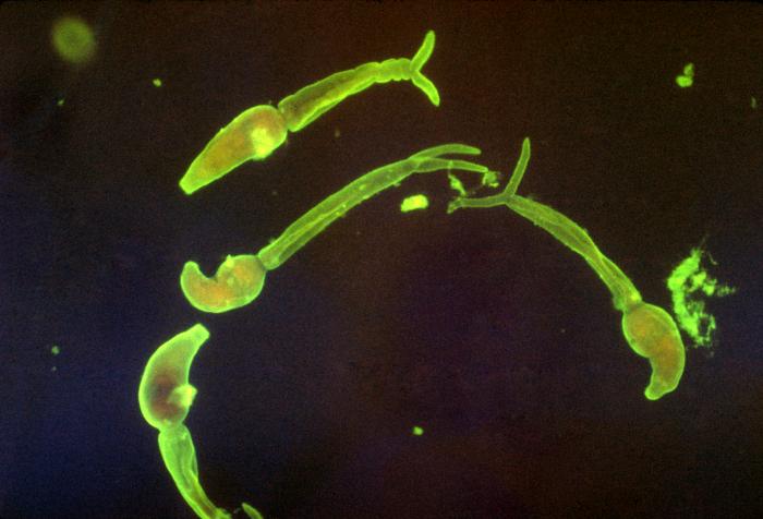 Cercarias de Schistosoma mansoni. CDC Public Health Image Library (PHIL).