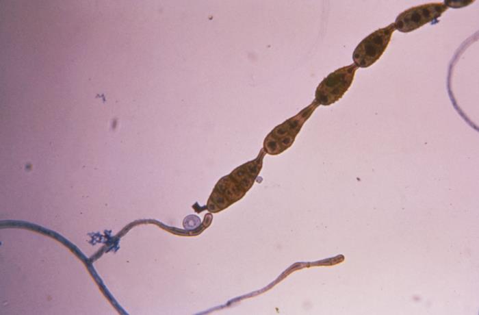 Alternaria spp. CDC Public Health Image Library (PHIL)