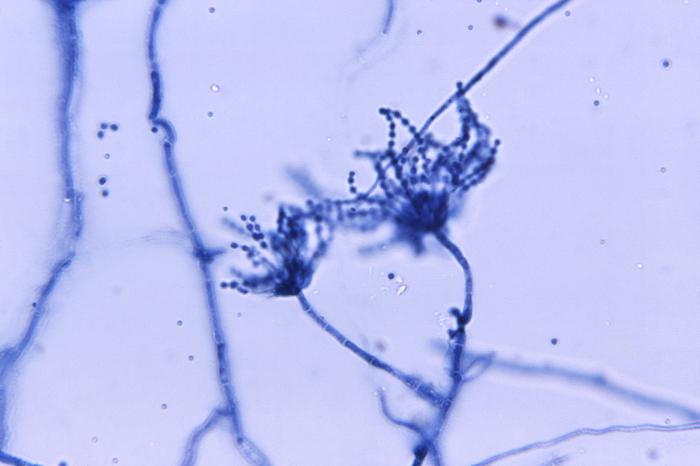 Conidióforos de P. marneffei. CDC Public Health Image Library (PHIL).