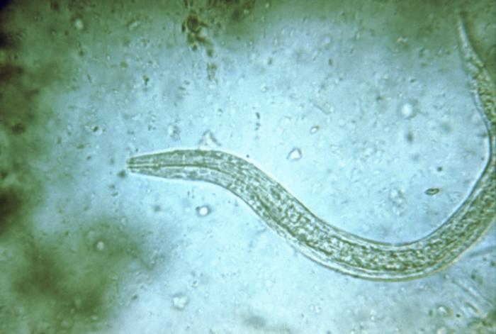 Larva filariforme. CDC Public Health Image Library (PHIL).
