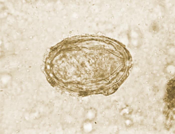 Huevo de Schistosoma japonicum. CDC Public Health Image Library (PHIL).                                                