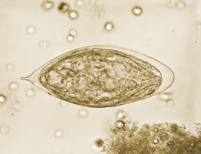 Huevo de Schistosoma haematobium.  CDC Public Health Image Library (PHIL).