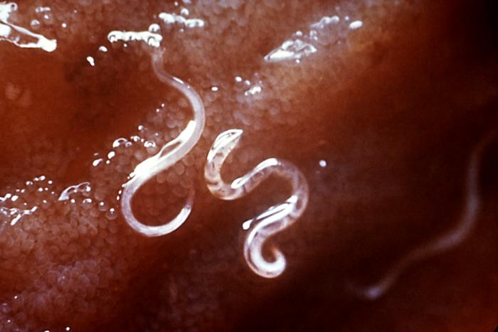 Ancylostoma caninum. CDC Public Health Image Library (PHIL 