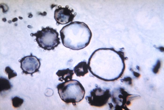 Levadura P. brasiliensis. CDC Public Health Image Library (PHIL).