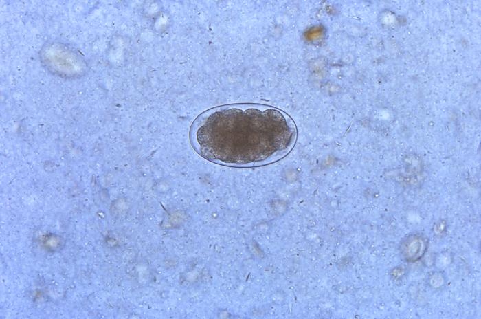 Huevo embrionado de N. americanus. CDC Public Health Image Library (PHIL).