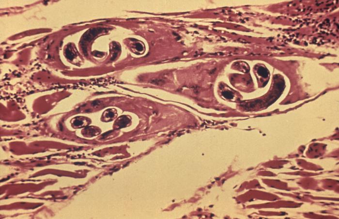 Trichinella sp.CDC Public Health Image Library (PHIL).                   