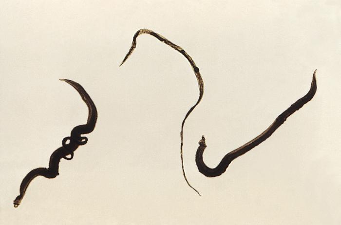 Distintas formas de Schistosoma mansoni. Hembra en el centro, macho en la derecha y ambos en acoplamiento en la izquierda. CDC Public Health Image Library (PHIL).