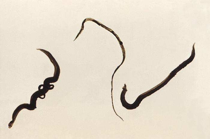Distintas formas de Schistosoma mansoni. Hembra en el centro, macho en la derecha y ambos en acoplamiento en la izquierda. CDC Public Health Image Library (PHIL).