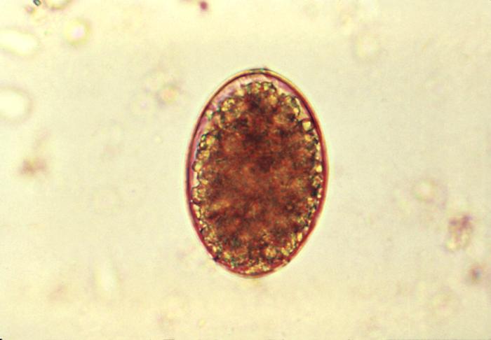 Huevos de D. latum. CDC Public Health Image Library (PHIL).