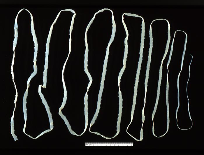 T. saginata adulta. CDC Public Health Image Library (PHIL).