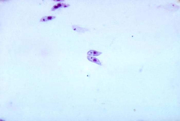 Promastigotes de Leishmania sp. CDC Public Health Image Library (PHIL).         