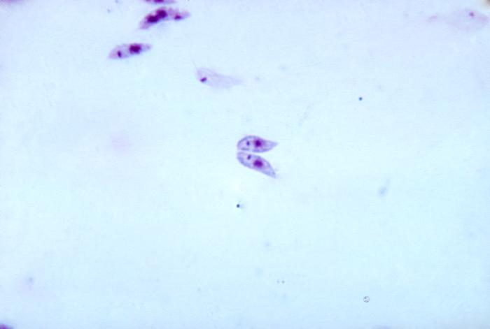 Promastigotes de Leishmania sp. CDC Public Health Image Library (PHIL). 