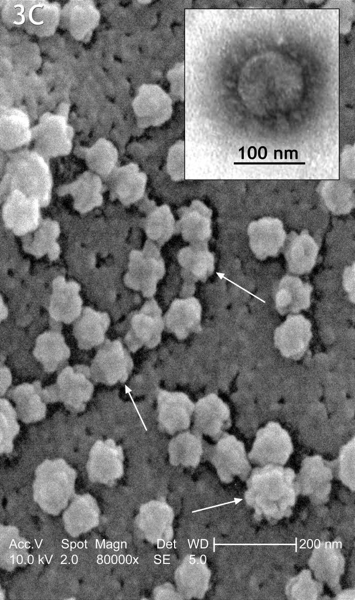 SARS-CoV (coronavirus). CDC Public Health Image Library (PHIL).