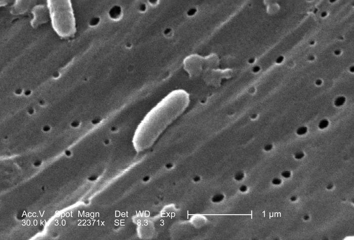 Vibrio cholerae. CDC Public Health Image Library (PHIL).