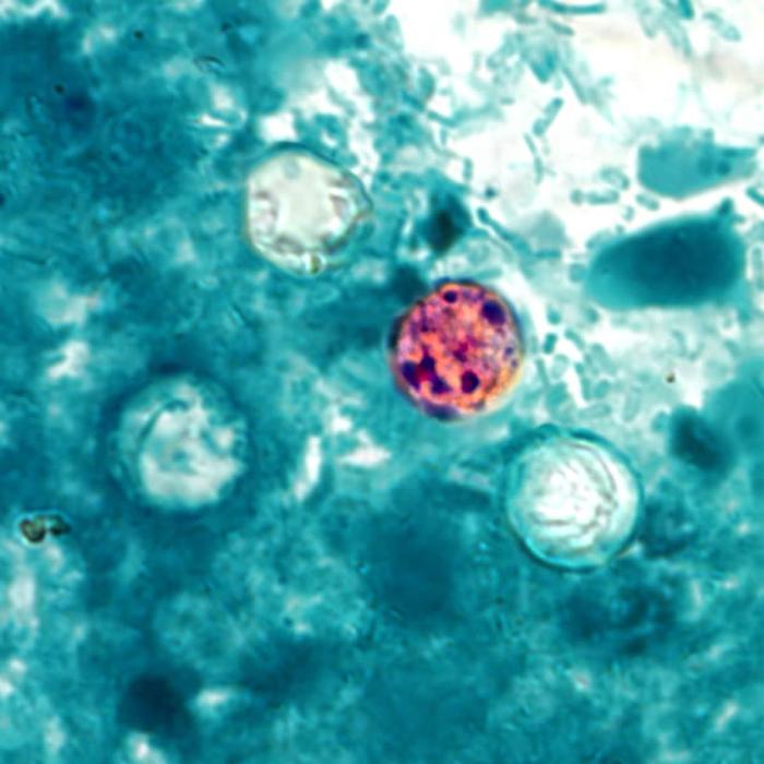 Ooquistes de Cyclospora cayetanensis. CDC Public Health Image Library (PHIL).