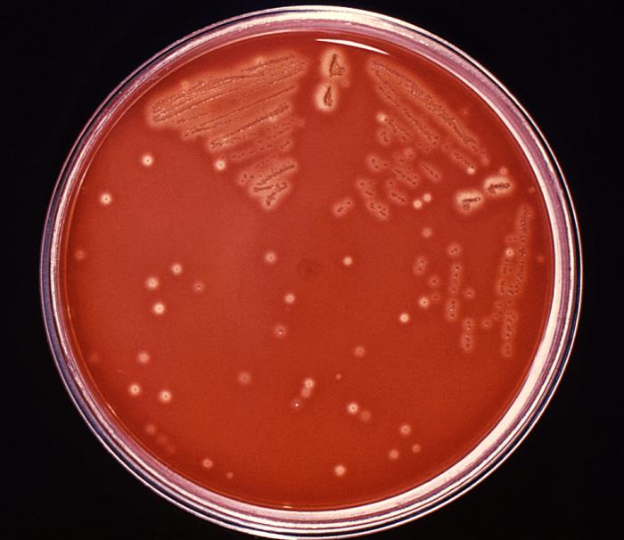 CDC Public Health Image Library (PHIL).