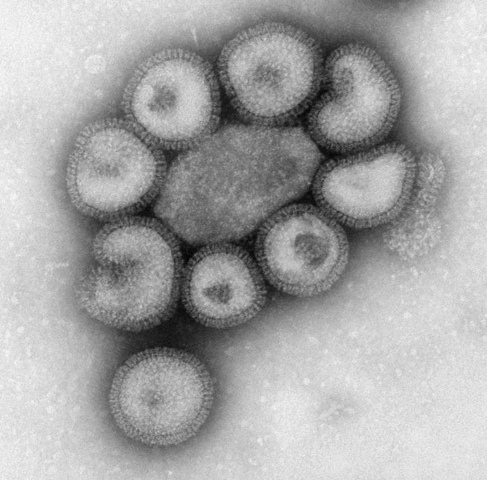 Viriones de Virus de la influenza. CDC Public Health Image Library (PHIL).