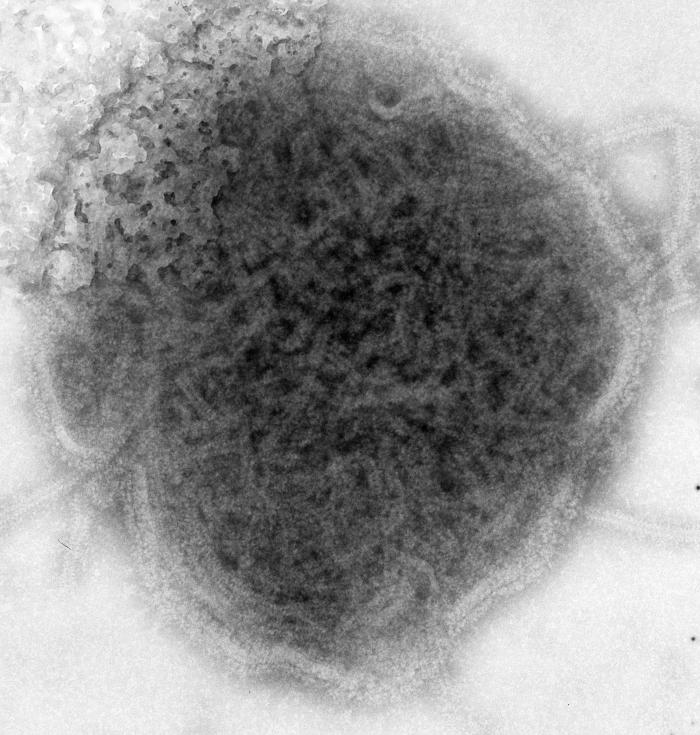 Virus de las paperas. CDC Public Health Image Library (PHIL).