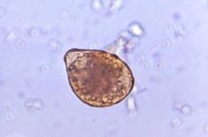 Huevo de A. lumbricoides. CDC Public Health Image Library (PHIL).