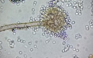 Aspergillus flavus (conidióforo y conidios) de Scot Nelson. 