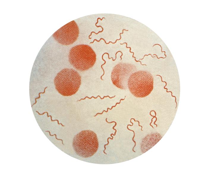 Borrelia recurrentis. CDC Public Health Image Library (PHIL). 