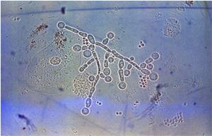 Clamidosporas de C. albicans. CDC Public Health Image Library (PHIL)