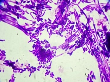 Candida dubliniensis de Stefan Walkowski.