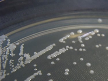 Cultivo de Candida glabrata de Nathan Reading