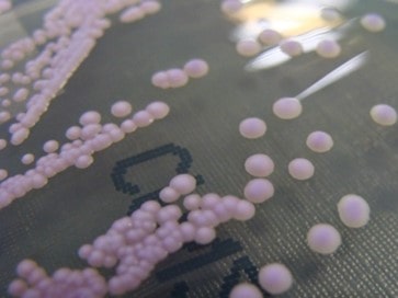 Cultivo de Candida tropicalis de Nathan Reading.