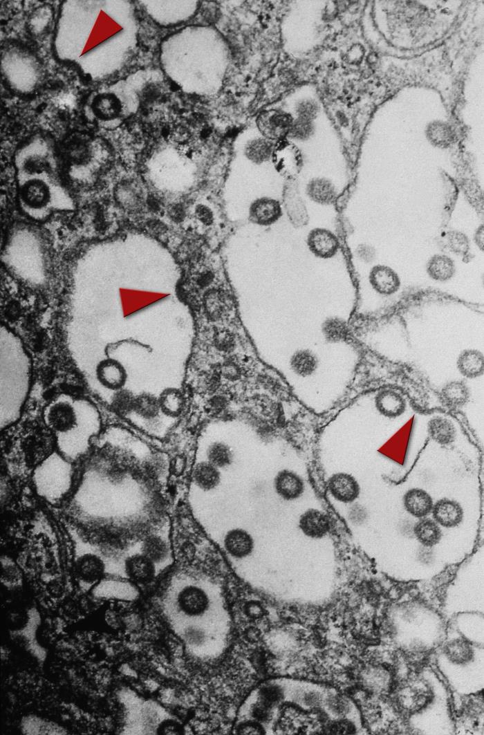 Viriones del virus del valle del Rift. CDC Public Health Image Library (PHIL).